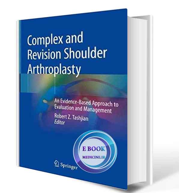 دانلود کتابComplex and Revision Shoulder Arthroplasty: An Evidence-Based Approach to Evaluation and Management 1st ed. 2019 ( PDF)